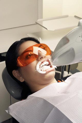clareamento dental a laser