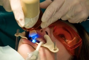 foto de um dentista realizando clareamento dental em paciente