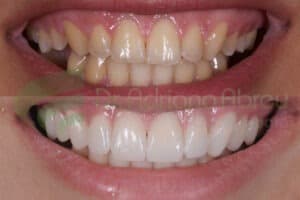 Situação inicial e final de um caso clínico