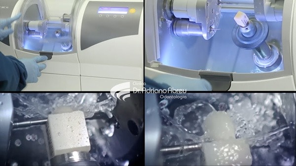 A tecnologia das impressoras 3D de Dentes 