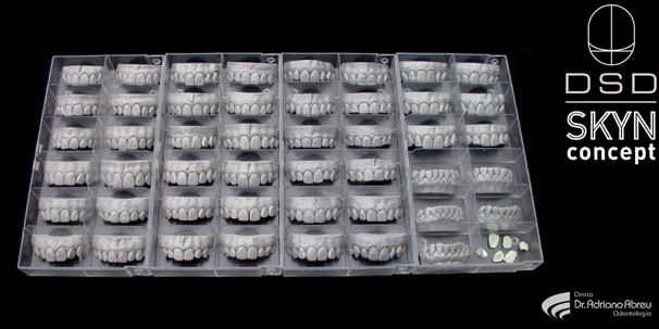 Catálogo de belos sorrisos, formados por dentes naturais, feito nos estudos de Jan Hajtó